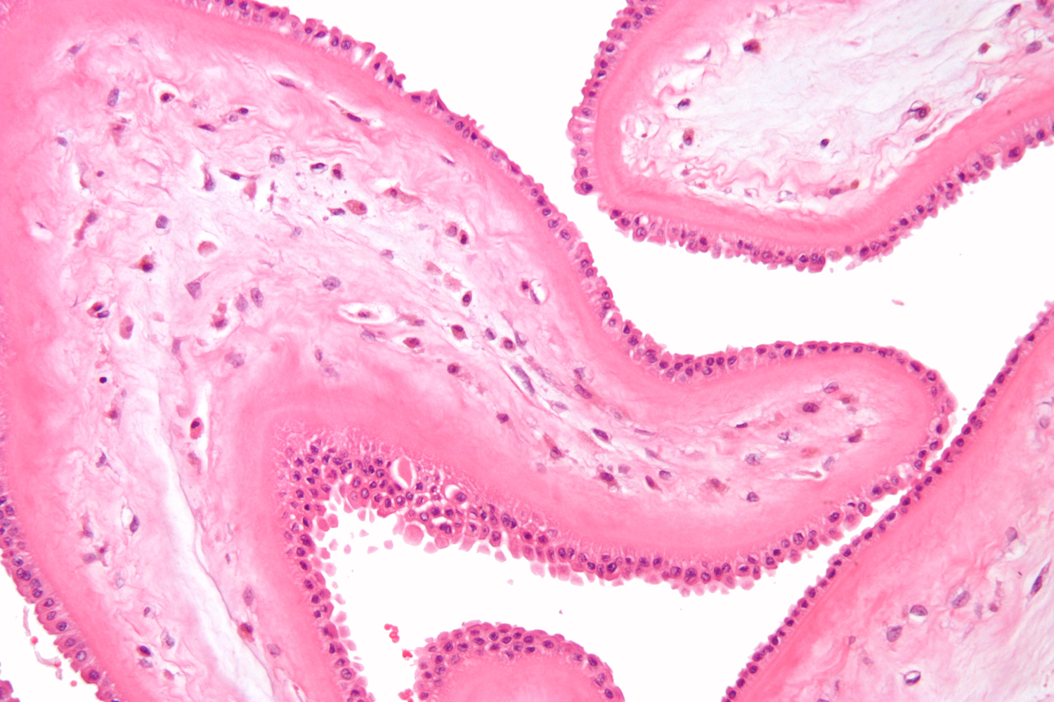 Microscopic photograph of fetal membrane (“There is, I know, a gestational commune —and I want to live in it…”  1)